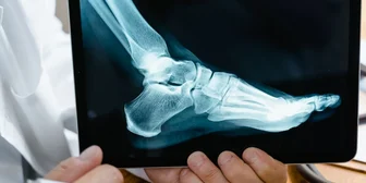 Research Study on Diabetic Foot Infections - $100 - $100 - 10/17/2026