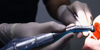 Research Study on Digital Restoration Design for Dental Assistants - $65 - $65 - 09/09/2026