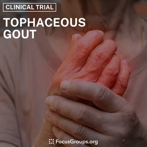 Clinical Trial on Tophaceous Gout