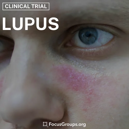 Clinical Trial on Lupus