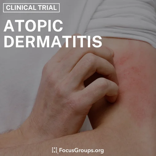 Clinical Trial on Atopic Dermatitis