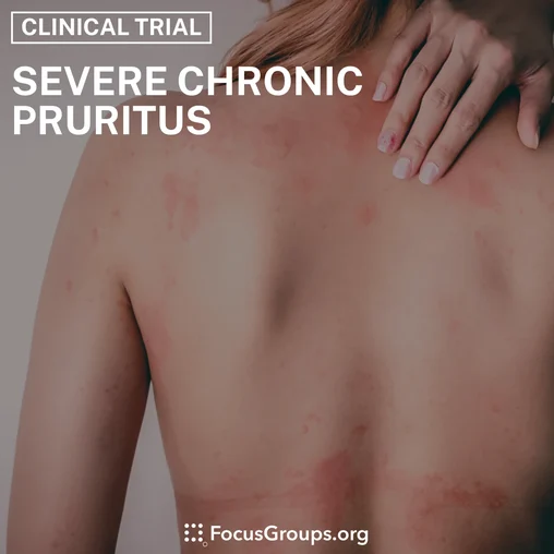 Clinical Trial on Severe Chronic Pruritus