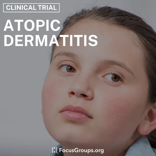 Clinical Trial on Atopic Dermatitis