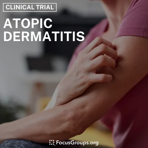 Clinical Trial on Adult Atopic Dermatitis