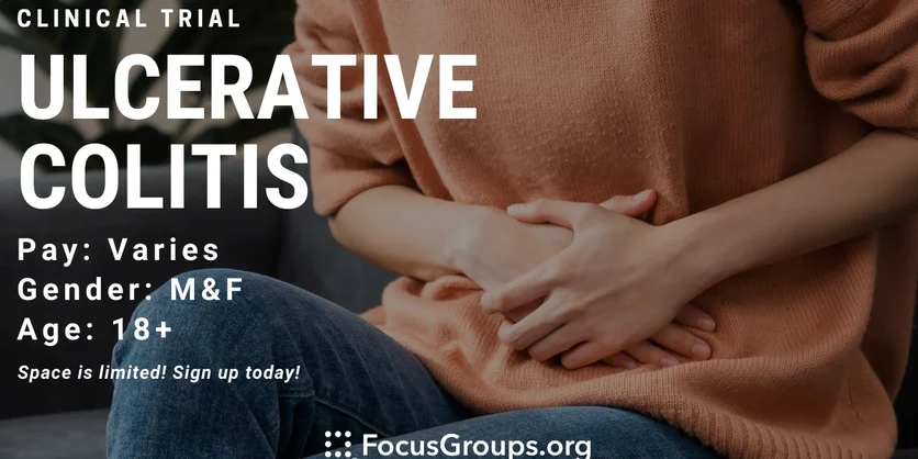 Clinical Trial on Ulcerative Colitis - TBD - 09/21/2022