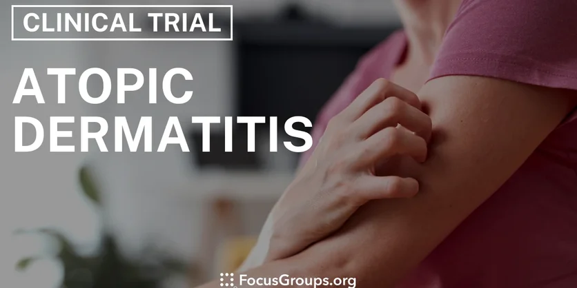 Clinical Trial on Adult Atopic Dermatitis - Varies - 01/22/2025