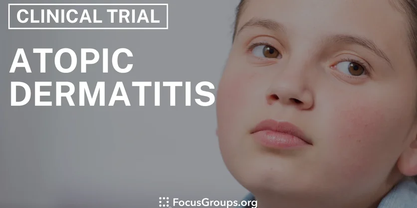 Clinical Trial on Atopic Dermatitis - Varies - 11/22/2024