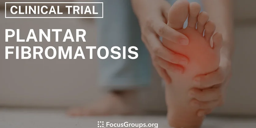 Clinical Trial on Plantar Fibromatosis - Varies - 10/10/2024