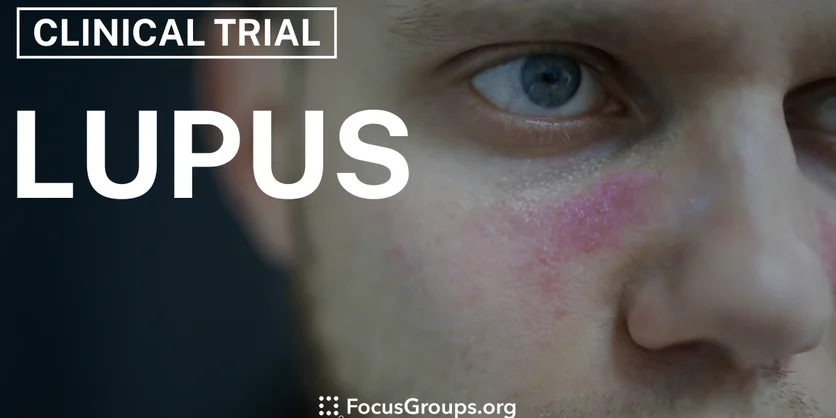 Clinical Trial on Lupus - Varies - 12/18/2024