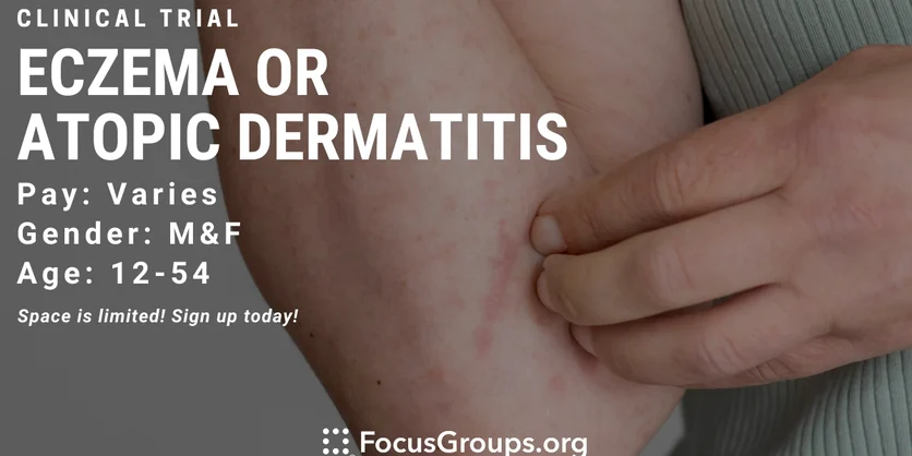 Eczema - Atopic Dermatitis - Clinical Trial (DMS) - TBD - 01/19/2022