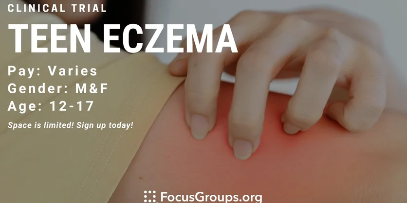 Clinical Trial on Teen Eczema - TBD - 10/03/2022