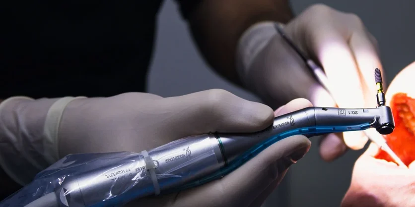 Research Study on Digital Restoration Design for Dental Assistants - $65 - $65 - 09/09/2026