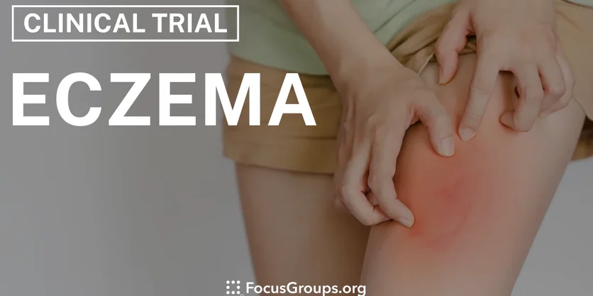 Clinical Trial on Eczema - Varies - 03/13/2025