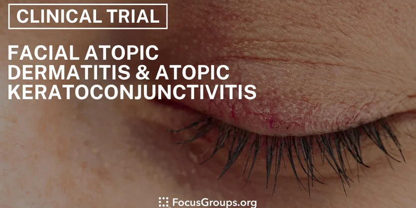 Clinical Trial on Facial Atopic Dermatitis & Atopic Keratoconjunctivitis - Clinical Trial on Facial Atopic Dermatitis & Atopic Keratoconjunctivitis - 08/23/2024