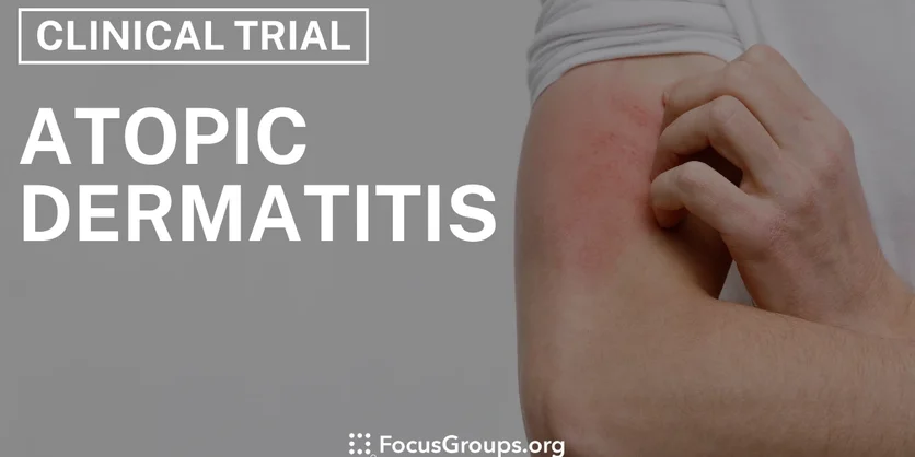 Clinical Trial on Atopic Dermatitis - Varies - 12/03/2024