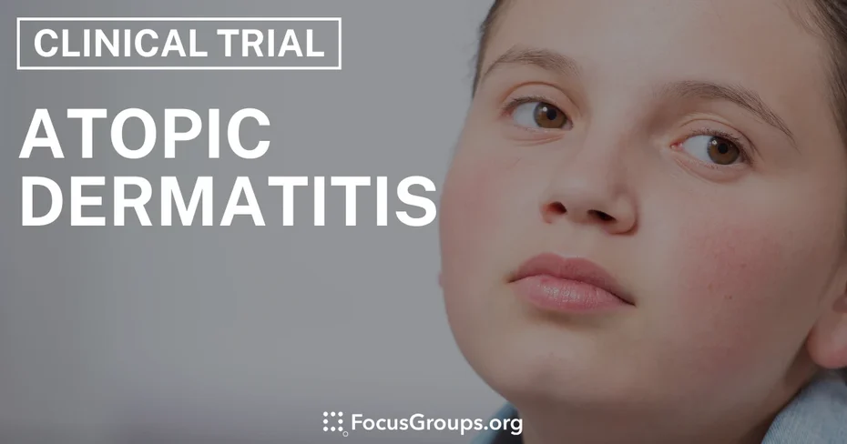 Clinical Trial on Atopic Dermatitis