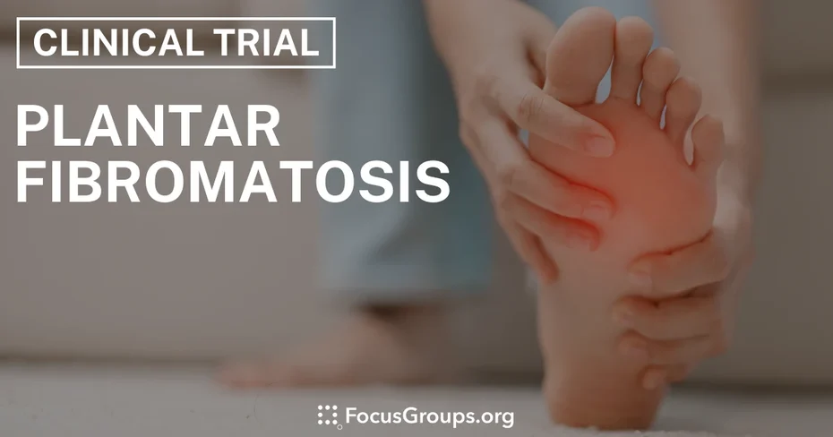 Clinical Trial on Plantar Fibromatosis