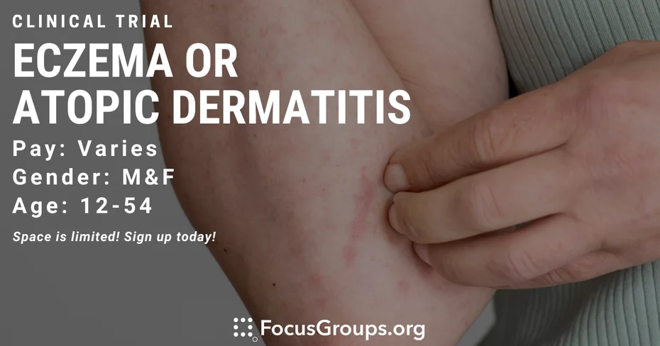 Eczema - Atopic Dermatitis - Clinical Trial (DMS)