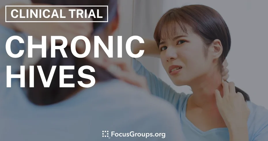 Clinical Trial on Chronic Hives - Varies - 11/04/2025