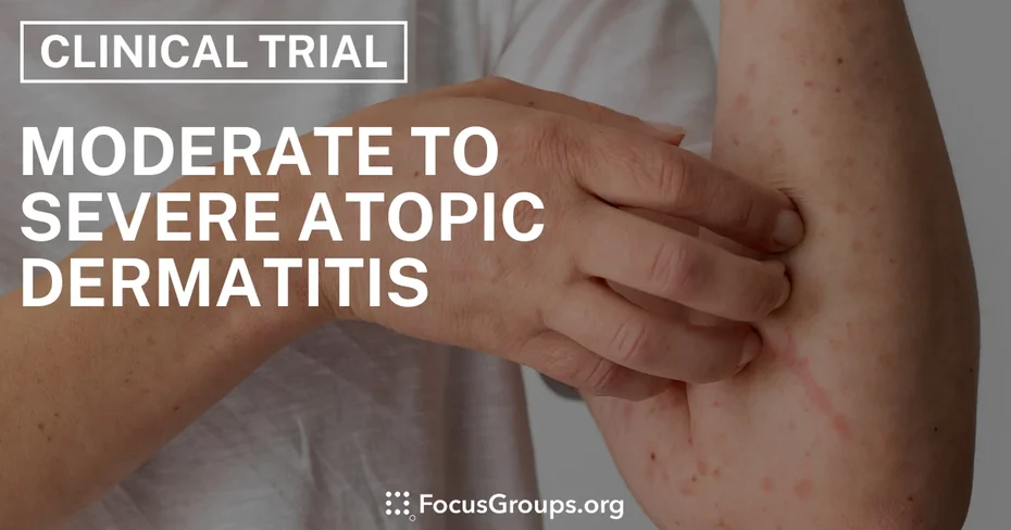 Clinical Trial on Moderate to Severe Atopic Dermatitis