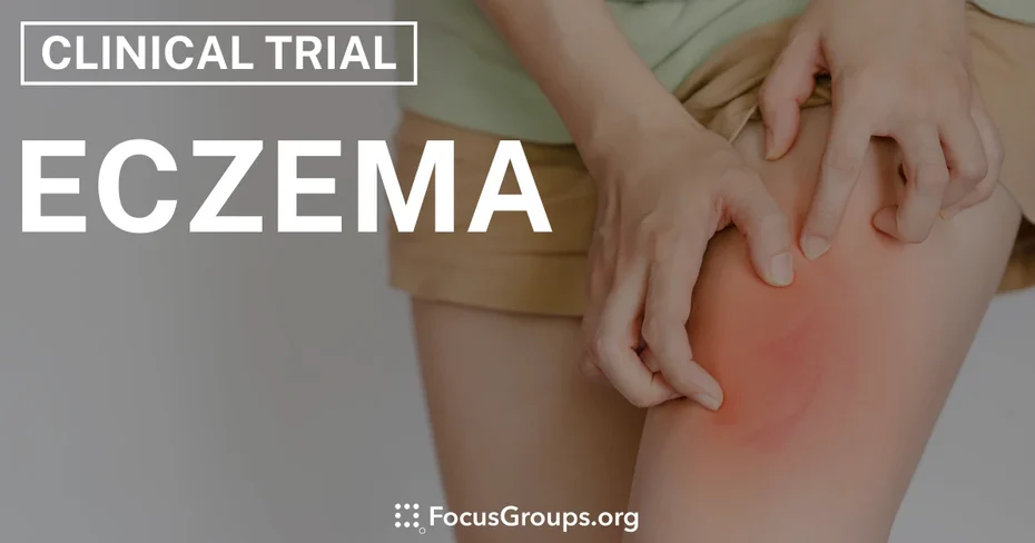 Clinical Trial on Eczema