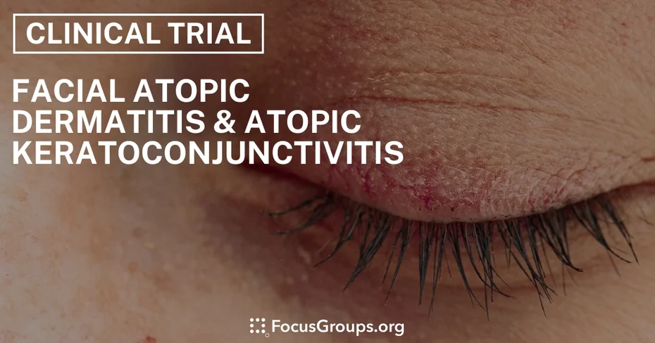 Clinical Trial on Facial Atopic Dermatitis & Atopic Keratoconjunctivitis