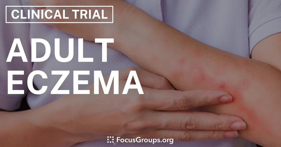 Clinical Trial on Adult Eczema